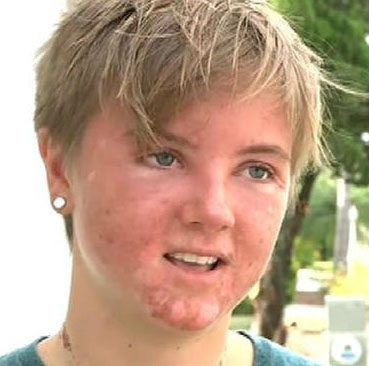 Positive Attitude College Girl Survives